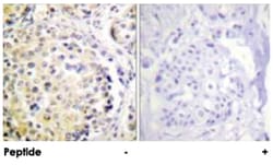 VIM Rabbit anti-Human, Polyclonal Antibody, Abnova 100&mu;g; Unlabeled:Antibodies,