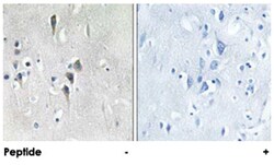 CAMK2A/CAMK2D, Rabbit, Polyclonal Antibody, Abnova 100&mu;g; Unlabeled:Antibodies,