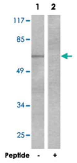Cttn Rabbit anti-Mouse, Rat, Polyclonal Antibody, Abnova 100&mu;g; Unlabeled:Antibodies,