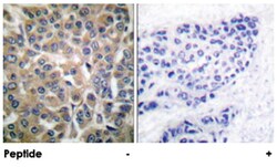 Cttn Rabbit anti-Mouse, Rat, Polyclonal Antibody, Abnova 100&mu;g; Unlabeled:Antibodies,