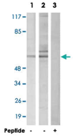 DAB1 Rabbit anti-Human, Mouse, Rat, Polyclonal Antibody, Abnova 100&mu;g;