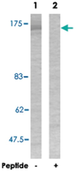 EGFR Rabbit anti-Human, Mouse, Rat, Polyclonal Antibody, Abnova 100 &mu;g | Buy Online | Abnova | Fisher Scientific
