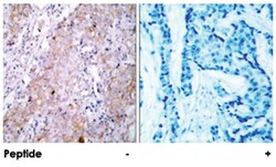 EGFR Rabbit anti-Human, Mouse, Rat, Polyclonal Antibody, Abnova 100 &mu;g | Buy Online | Abnova | Fisher Scientific