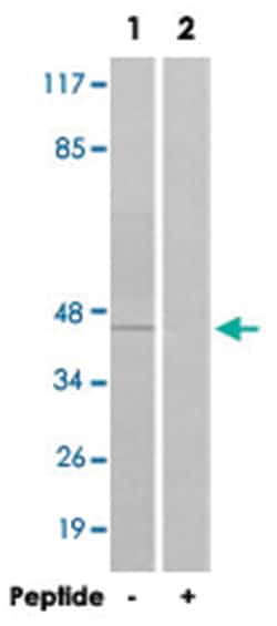 MAPK9/MAPK8 Rabbit anti-Human, Mouse, Rat, Polyclonal Antibody, Abnova