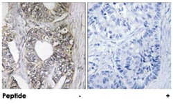 MAPK9/MAPK8 Rabbit anti-Human, Mouse, Rat, Polyclonal Antibody, Abnova