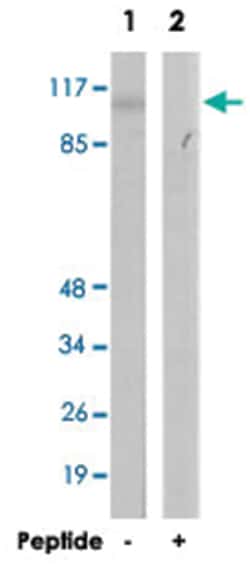 GRIN1 Rabbit anti-Human, Mouse, Rat, Polyclonal Antibody, Abnova 100&mu;g;