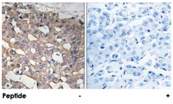 STMN1 Rabbit anti-Human, Mouse, Rat, Polyclonal Antibody, Abnova 100 &mu;g | Buy Online | Abnova | Fisher Scientific