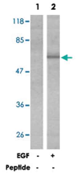 EZR (phospho T353), Rabbit anti-Human, Mouse, Polyclonal Antibody, Abnova