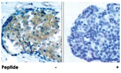 EZR (phospho T353), Rabbit anti-Human, Mouse, Polyclonal Antibody, Abnova