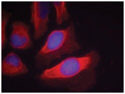 IKBKB (phospho T199), Rabbit anti-Human, Mouse, Rat, Polyclonal Antibody,