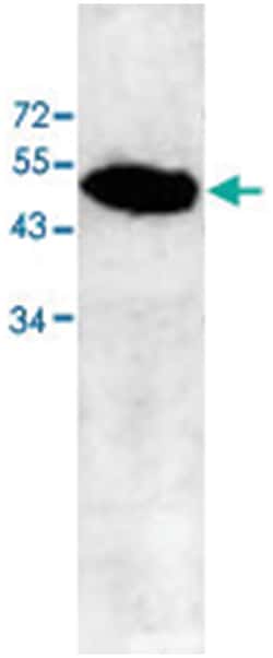 ABHD12B Rabbit anti-Human, Polyclonal Antibody, Abnova 100&mu;g; Unlabeled:Antibodies,