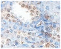 ABHD12B Rabbit anti-Human, Polyclonal Antibody, Abnova 100&mu;g; Unlabeled:Antibodies,