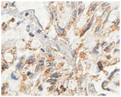 AARSD1, Rabbit, Polyclonal Antibody, Abnova 100 &mu;g | Buy Online | Abnova | Fisher Scientific
