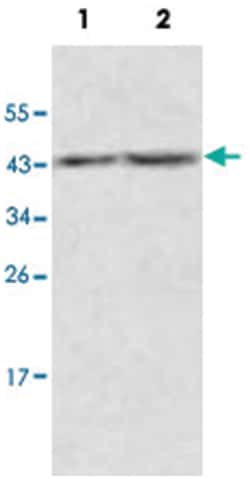 ACOT9, Rabbit, Polyclonal Antibody, Abnova 100&mu;g; Unlabeled:Antibodies,
