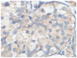 ACOT9, Rabbit, Polyclonal Antibody, Abnova 100&mu;g; Unlabeled:Antibodies,