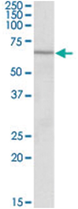 ACADVL, Goat, Polyclonal Antibody, Abnova 100&mu;g; Unlabeled:Antibodies,