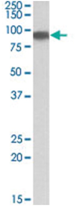 ACO2 Goat anti-Human, Polyclonal Antibody, Abnova 100 &mu;g | Buy Online | Abnova | Fisher Scientific