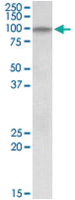 DAG1, Goat, Polyclonal Antibody, Abnova 100&mu;g; Unlabeled:Antibodies,