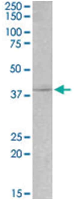 MYOG, Goat, Polyclonal Antibody, Abnova 100 &mu;g | Buy Online | Abnova | Fisher Scientific