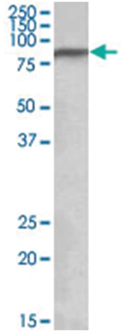 NDUFS1, Goat, Polyclonal Antibody, Abnova 100&mu;g; Unlabeled:Antibodies,