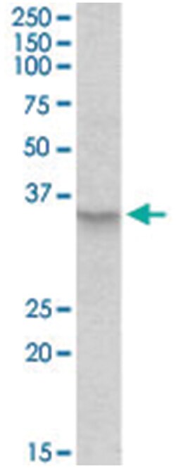 PXMP3, Goat, Polyclonal Antibody, Abnova 100 &mu;g | Buy Online | Abnova Corporation | Fisher Scientific