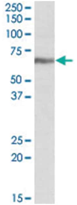 IGF2BP1, Goat, Polyclonal Antibody, Abnova 100&mu;g; Unlabeled:Antibodies,
