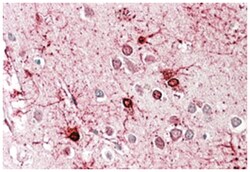 GLUD1/GLUD2, Goat, Polyclonal Antibody, Abnova 100&mu;g; Unlabeled:Antibodies,