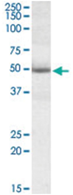 GATA3, Goat, Polyclonal Antibody, Abnova 100&mu;g; Unlabeled:Anticuerpos