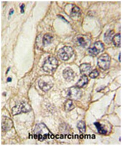 CDH6, Rabbit, Polyclonal Antibody, Abnova 400 &mu;L | Buy Online | Abnova | Fisher Scientific