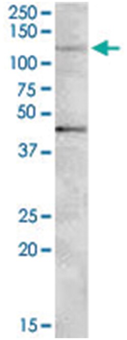 TNKS2 Goat anti-Human, Polyclonal Antibody, Abnova 100&mu;g; Unlabeled:Antibodies,