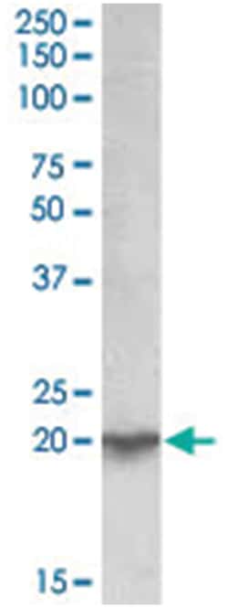 UXT, Goat, Polyclonal Antibody, Abnova 100 &mu;g | Buy Online | Abnova | Fisher Scientific