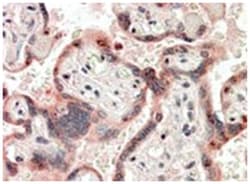 TDGF1, Goat, Polyclonal Antibody, Abnova 100&mu;g; Unlabeled:Antibodies,