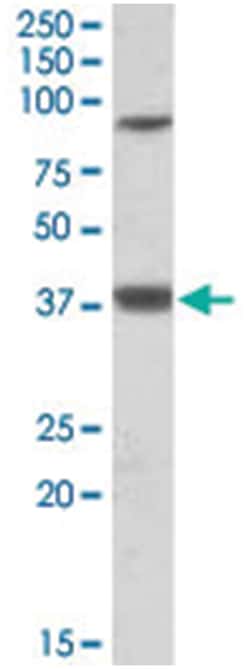 LASS1, Goat, Polyclonal Antibody, Abnova 100&mu;g; Unlabeled:Antibodies,