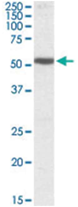 HTR3B Goat anti-Human, Polyclonal Antibody, Abnova 100&mu;g; Unlabeled:Antibodies,