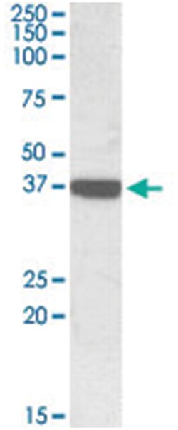 CNN3, Goat, Polyclonal Antibody, Abnova 100&mu;g; Unlabeled:Antibodies,