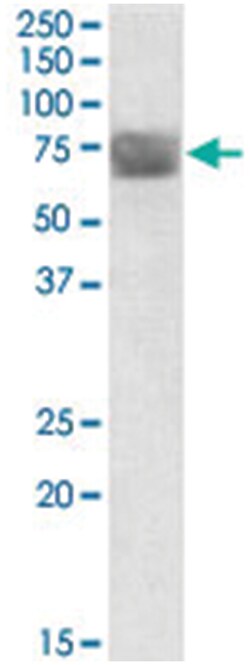 TPP1, Goat, Polyclonal Antibody, Abnova 100 &mu;g | Buy Online | Abnova | Fisher Scientific