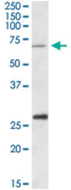 CPT2 Goat anti-Human, Mouse, Polyclonal Antibody, Abnova 100&mu;g; Unlabeled:Antibodies,