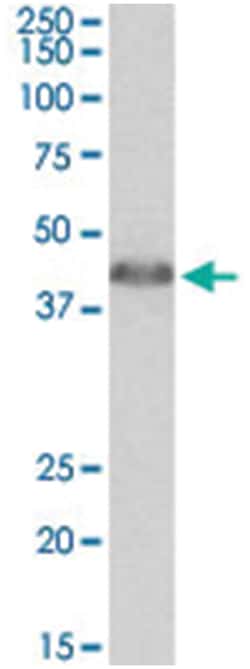 ACAT1 Goat anti-Human, Polyclonal Antibody, Abnova 100 &mu;g | Buy Online | Abnova Corporation | Fisher Scientific