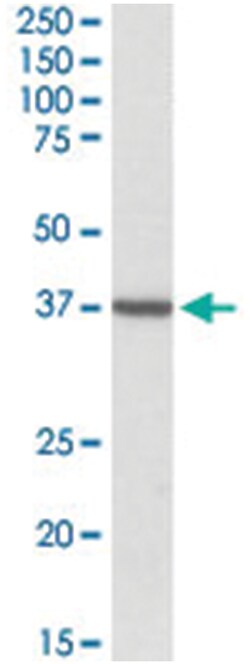 TOMM40, Goat, Polyclonal Antibody, Abnova 100 &mu;g | Buy Online | Abnova Corporation | Fisher Scientific