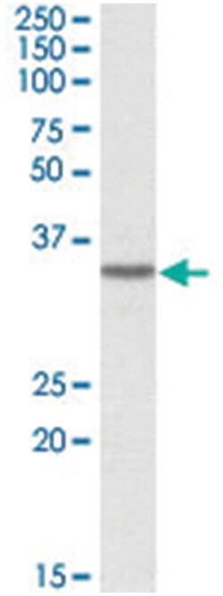 GHITM Goat anti-Human, Polyclonal Antibody, Abnova 100 &mu;g | Buy Online | Abnova Corporation | Fisher Scientific