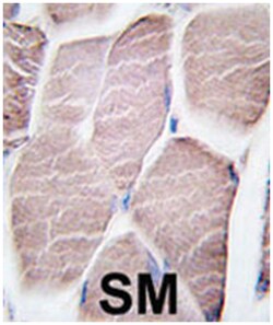 PYGM Rabbit anti-Human, Polyclonal Antibody, Abnova 400&mu;L; Unlabeled:Antibodies,