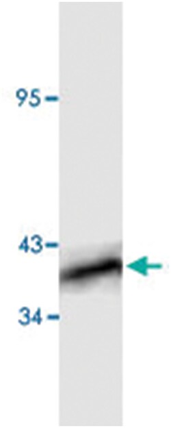 NFKBIB Rabbit anti-Human, Polyclonal Antibody, Abnova 100&mu;g; Unlabeled:Antibodies,