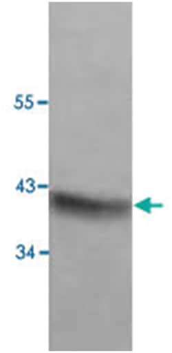 PAX2 Rabbit anti-Human, Polyclonal Antibody, Abnova 100&mu;g; Unlabeled:Antibodies,