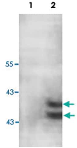 PARP11 Rabbit anti-Human, Mouse, Rat, Polyclonal Antibody, Abnova 100&mu;g;