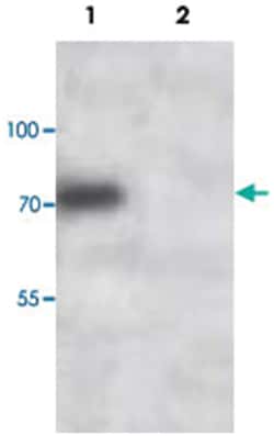 TRAP1, Rabbit, Polyclonal Antibody, Abnova 100 &mu;g | Buy Online | Abnova | Fisher Scientific