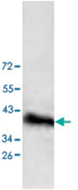 DPF1, Rabbit, Polyclonal Antibody, Abnova 100 &mu;g | Buy Online | Abnova | Fisher Scientific