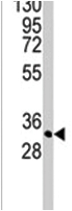 STAP1, Rabbit, Polyclonal Antibody, Abnova 400&mu;L; Unlabeled:Antibodies,
