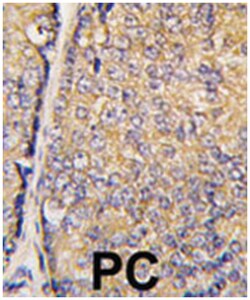 STAP1, Rabbit, Polyclonal Antibody, Abnova 400&mu;L; Unlabeled:Antibodies,