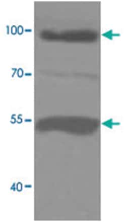 ADAMTS8, Rabbit, Polyclonal Antibody, Abnova 100&mu;g; Unlabeled:Antibodies,