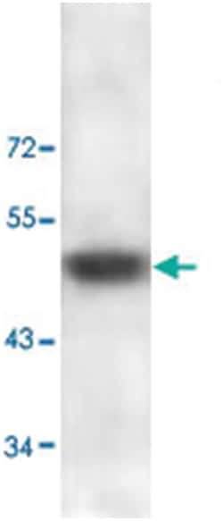 ADAMTS2, Rabbit, Polyclonal Antibody, Abnova 100 &mu;g | Buy Online | Abnova Corporation | Fisher Scientific